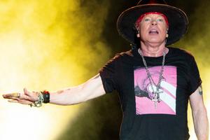 Bang Showbiz / Axl Rose recovering from jaw surgery