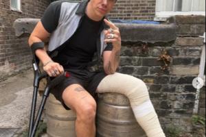 Bang Showbiz / Yungblud is in a cast after breaking his leg in a motorcycle accident