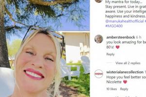 Bang Showbiz / Nicollette Sheridan suffers 'third-degree rope burns' after 'ugly and painful' dog incident