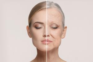 Aging process. Dreamstime/TCA