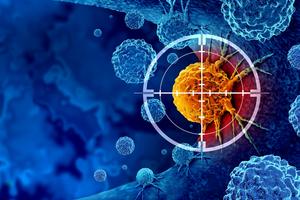 Pancreatic cancer has been notoriously difficult to target and treat. wildpixel/iStock via Getty Images Plus