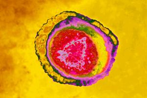 Varicella zoster virus, also known as human herpesvirus 3, causes chickenpox and shingles. BSIP/Universal Images Group via Getty Images