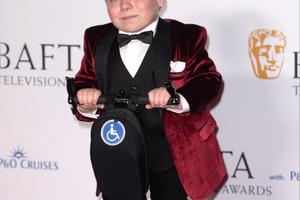 Bang Showbiz / Lenny Rush is' excited' to play Dobby.