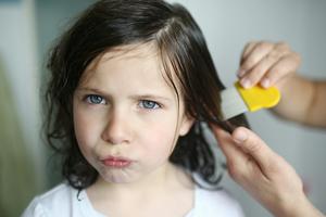 Headlice have a high ick factor, but thankfully but these insects aren't dangerous and don't spread disease.  Catherine DELAHAYE/Photononstop via Getty Images