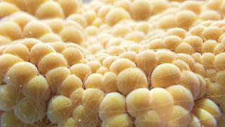 There is more to fat than meets the eye. Thom Leach/Science Photo Library via Getty Images